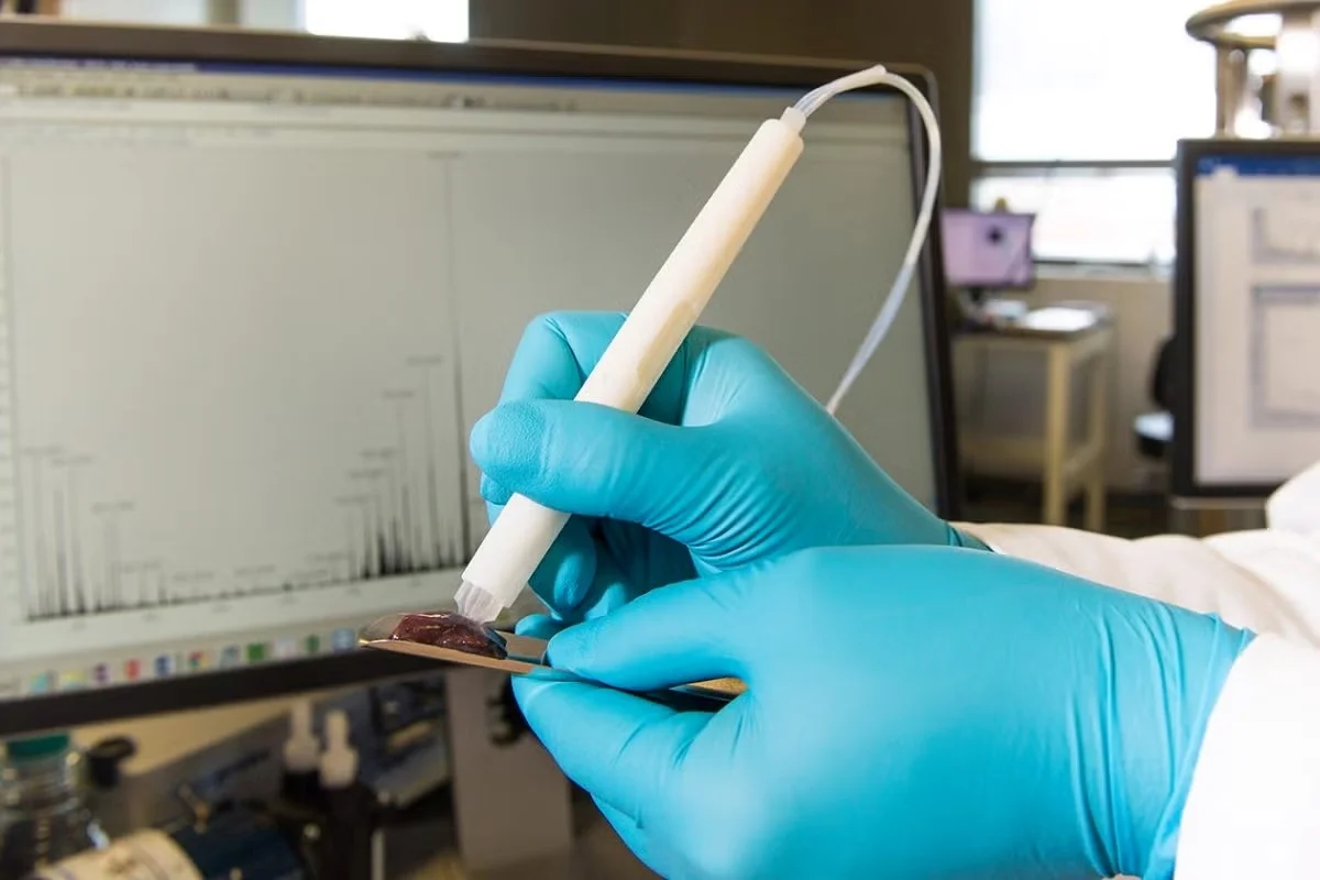 Caneta brasileira que identifica câncer em segundos passa por testes no Brasil