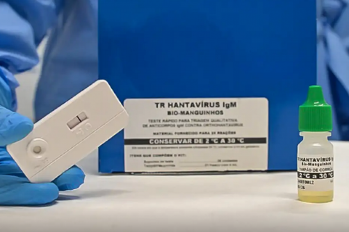 Anvisa aprova novo teste rápido para hantavirose com diagnóstico em apenas 20 minutos