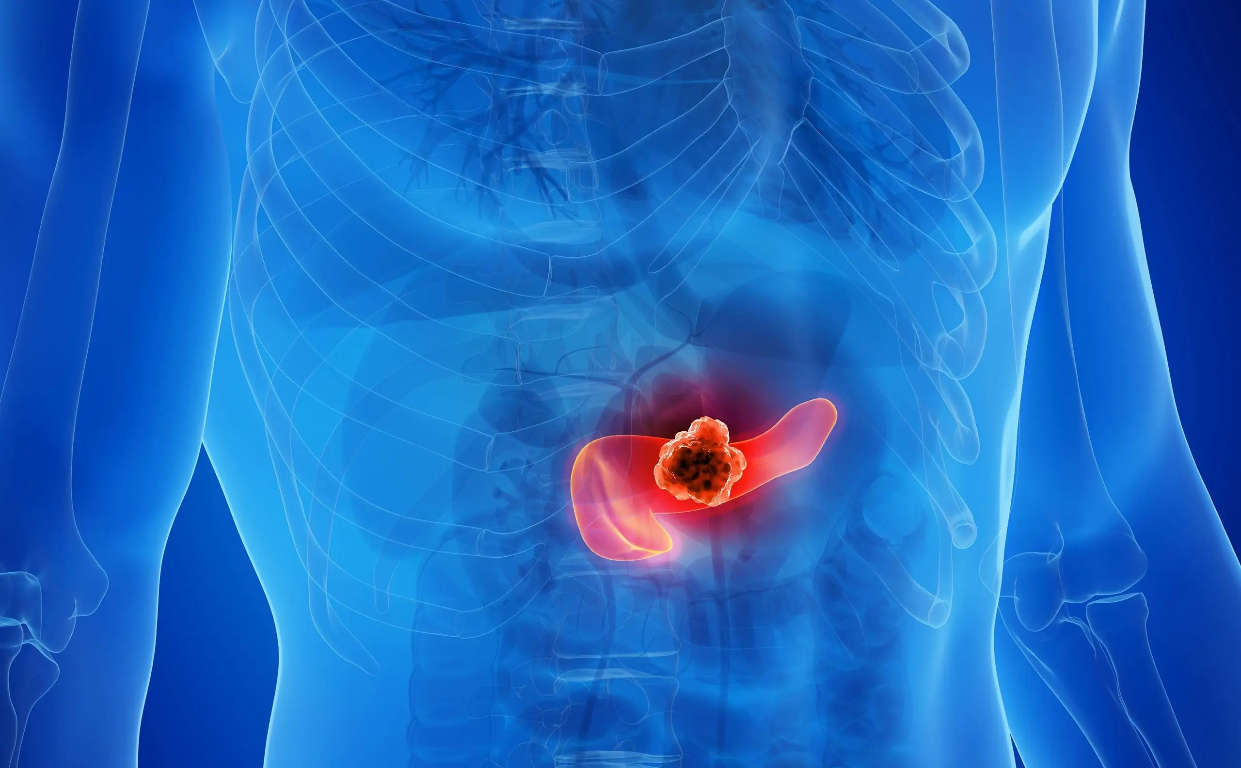 Pesquisadores conseguem eliminar tumores pancreáticos em testes com animais