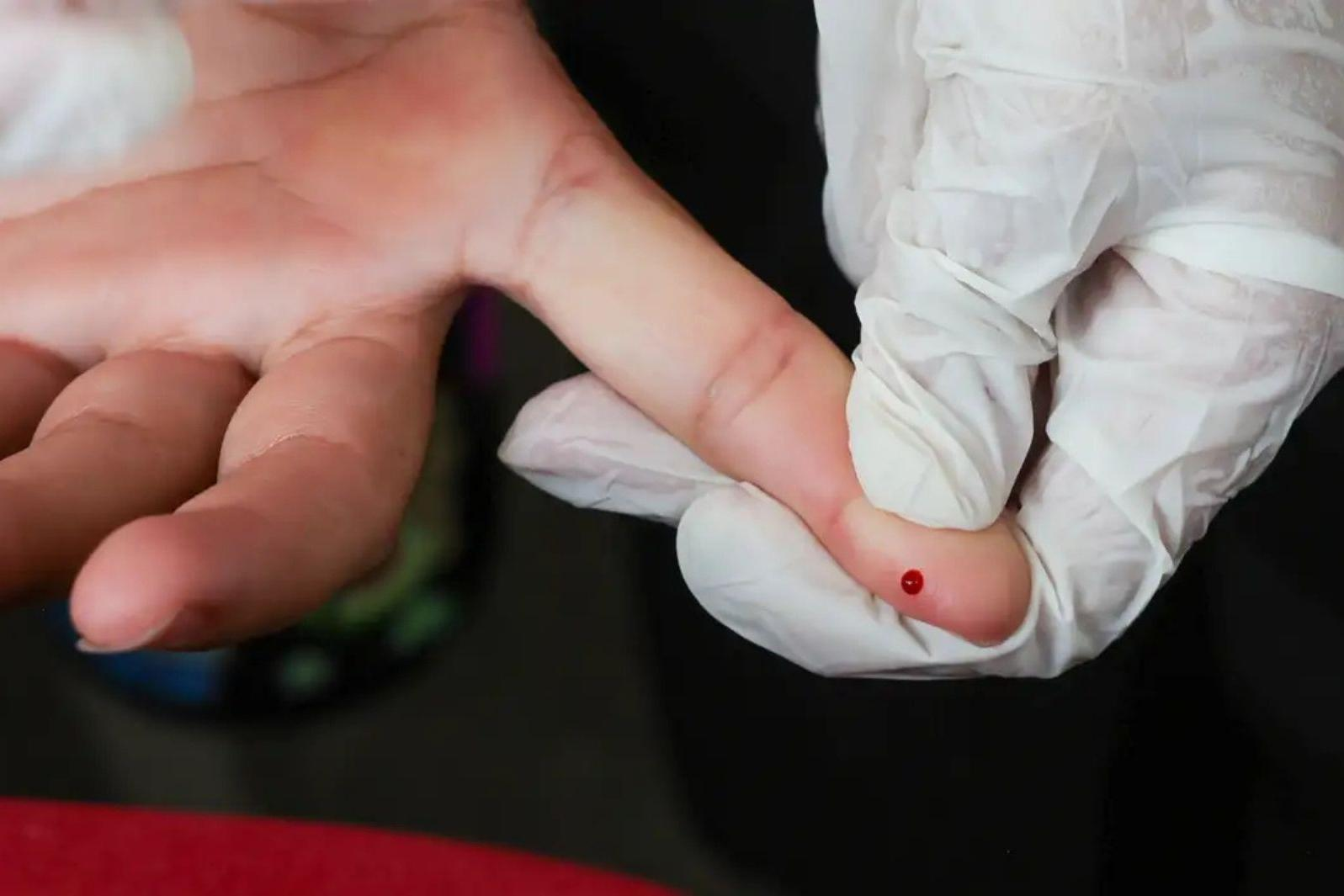 SUS inicia oferta de teste rápido para diagnóstico de dengue