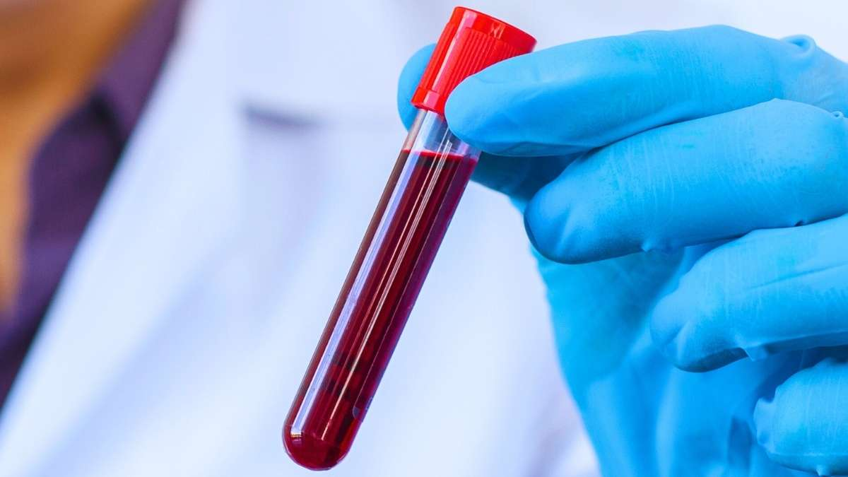 Estudo revela proteínas ligadas à longevidade e ao envelhecimento saudável